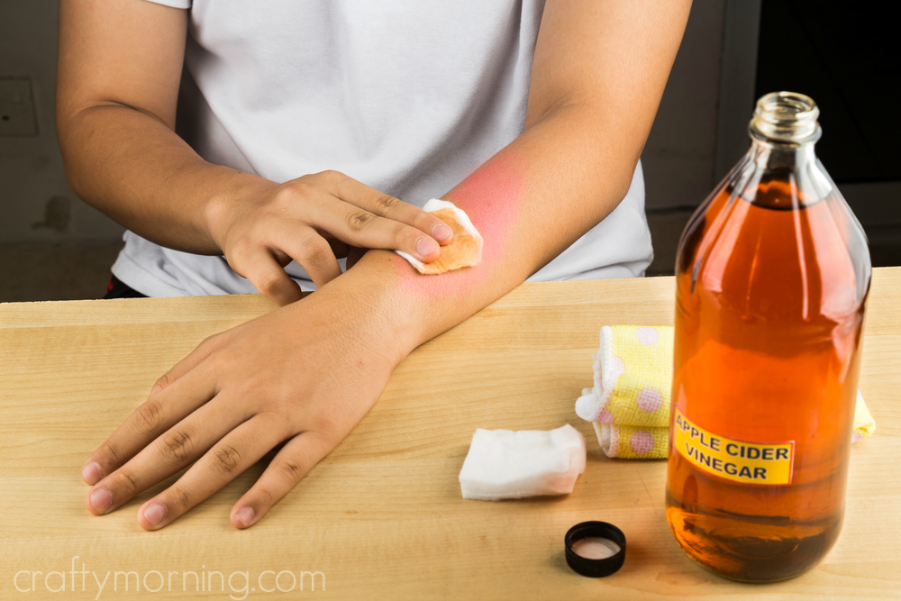 16 Incredible Uses That Prove Apple Cider Vinegar Is The Best Home Remedy -  Crafty Morning