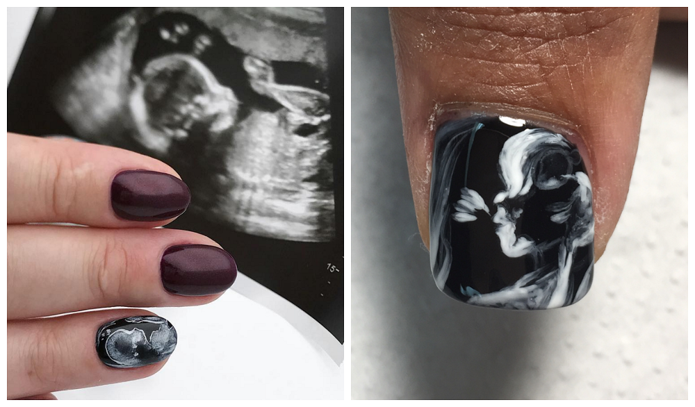 Pregnant Moms Now Using Their Sonograms For Nail Art